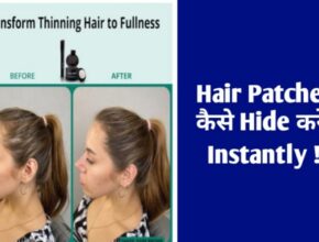 Hair Patches