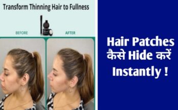 Hair Patches